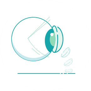 Common Myth Around Lenses